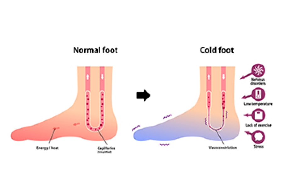 Symptoms Of Peripheral Artery Disease